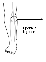 Leg veins