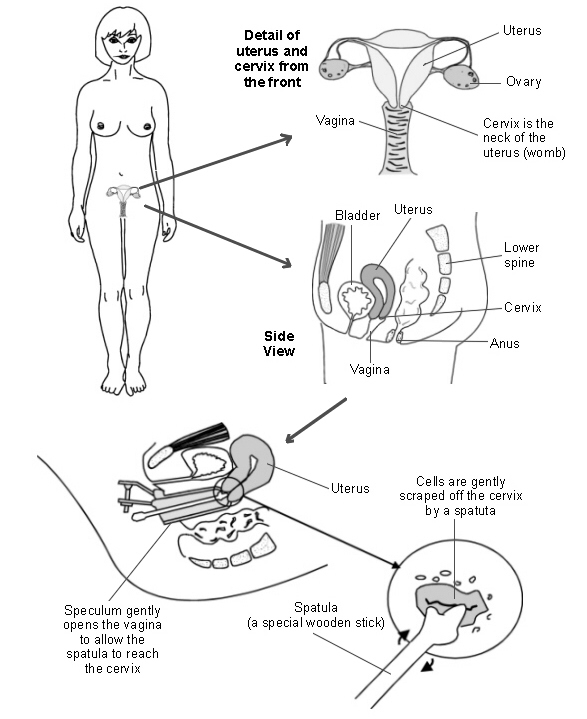 Diagram showing the female reproductive organs and how a cervical smear test is performed