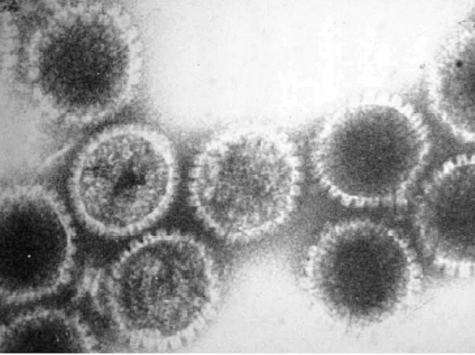 Human herpesvirus